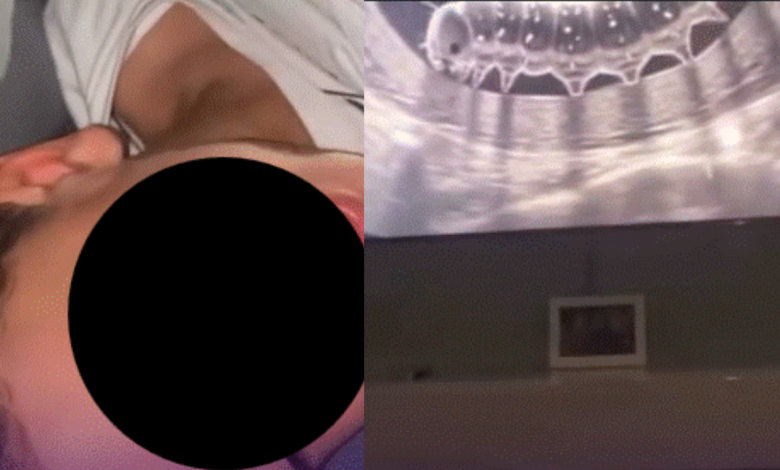 Un video grabado en Brasil muestra al menor angustiado después de que sus padres le hicieron creer que una ecografía revelaba un gusano en su estómago.