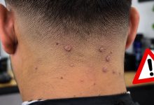 Navajas, tijeras y otros utensilios de peluquería que deben desinfectarse ante el riesgo de lesiones cutáneas por VPH