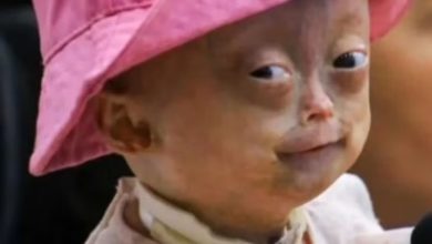 Elis Lima Carneiro, niña brasileña que ayudó a visibilizar la progeria en redes sociales
